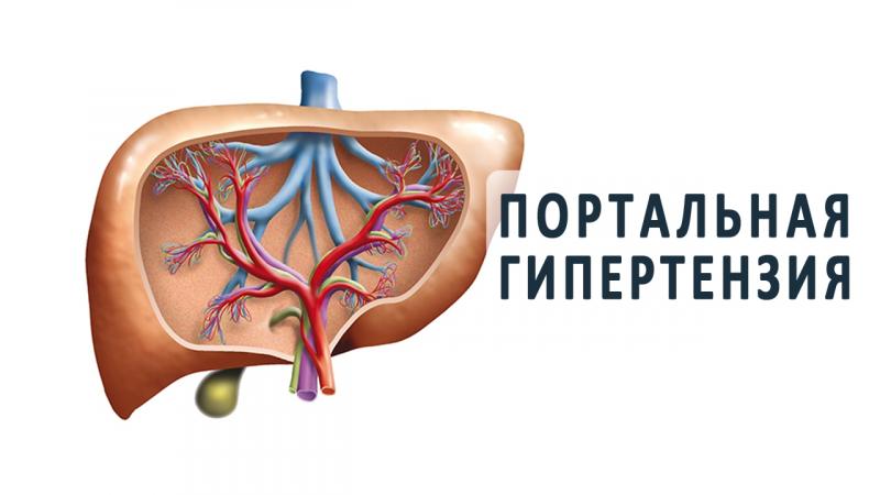 Портальная гипертензия - обзор от магазина медтехники ME-D.RU