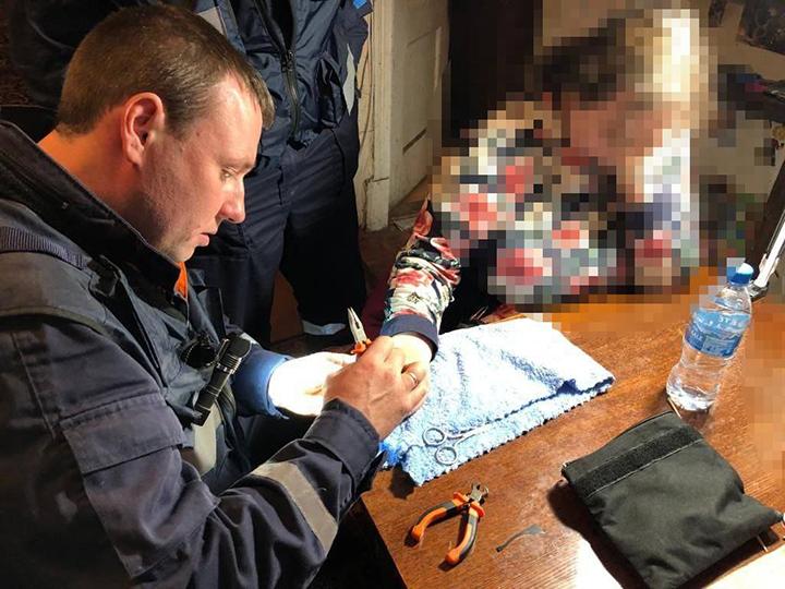 Работники ГКУ МО «Мособлпожспас» освободили женщину от сдавливающих палец колец