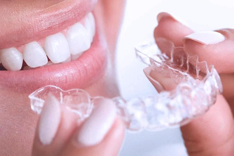 Российская компания-производитель элайнеров CLICK Aligners представила результаты исследования рынка